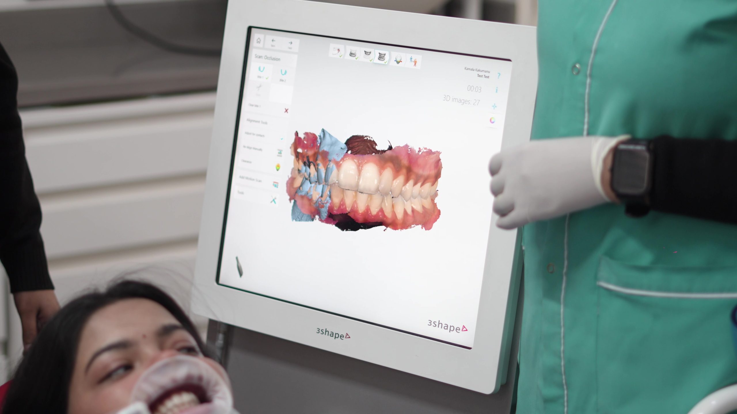 3D Intraoral Scanner 3D Intraoral Scanner