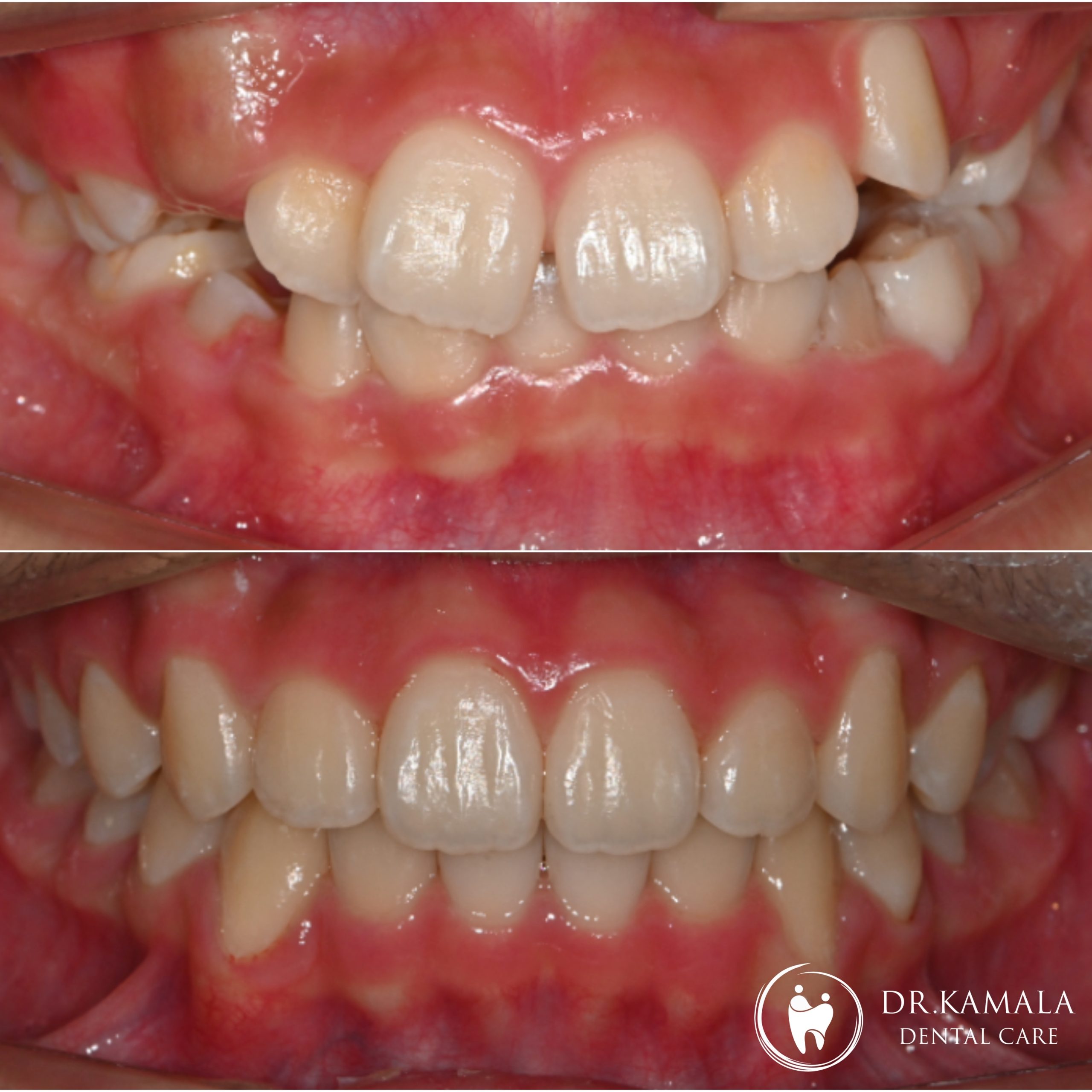 KAMALA DENTAL- Before & After 01.jpg